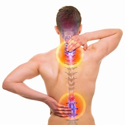 Spinal Stenosis