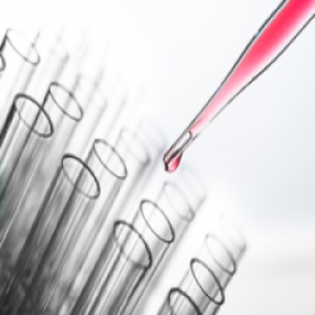 Lab test Image